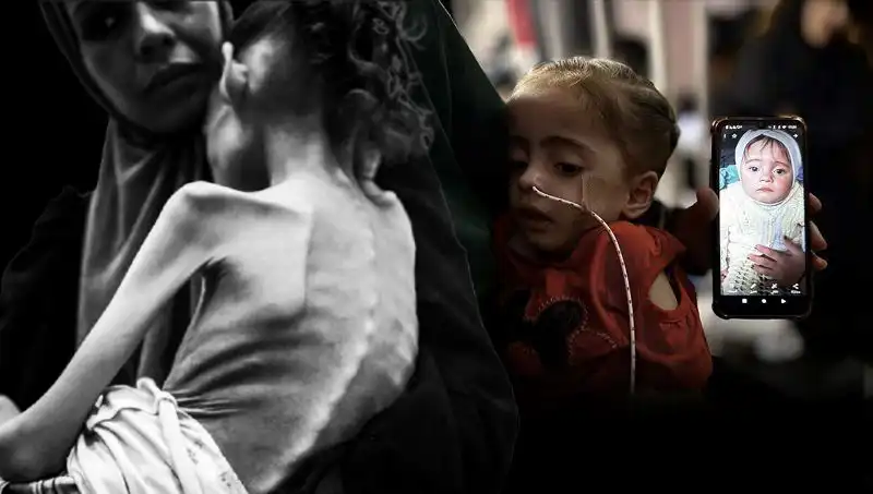 Küçük Meryem’in Dramı: 25 Kilodan 10 Kiloya Düştü!